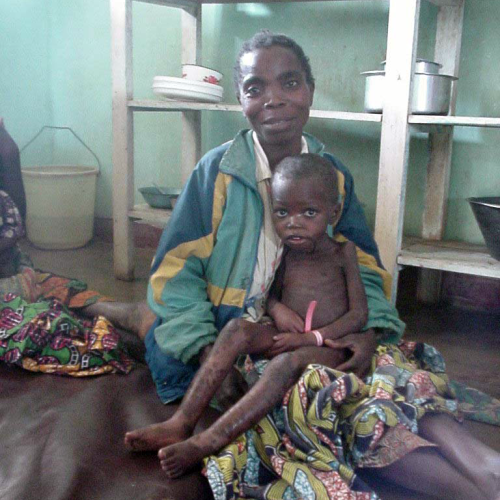 Adult holding malnourished boy in lap